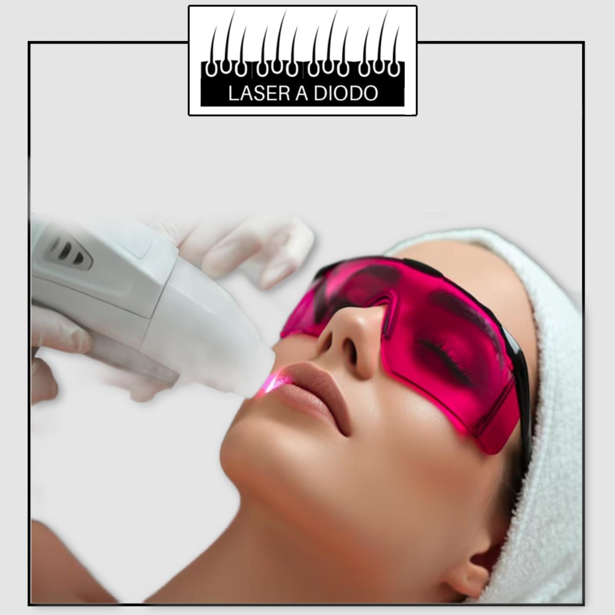 EPILAZIONE LASER A DIODO ZONA BAFFETTI