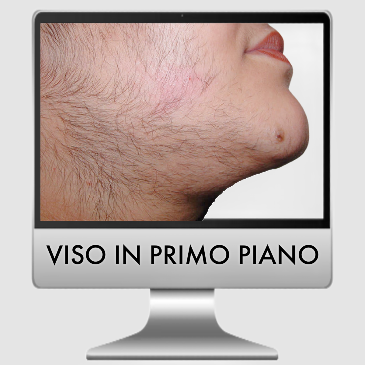 TRE EPILAZIONI LASER ALESSANDRITE : VISO + BAFFETTO + COLLO ANTERIORE