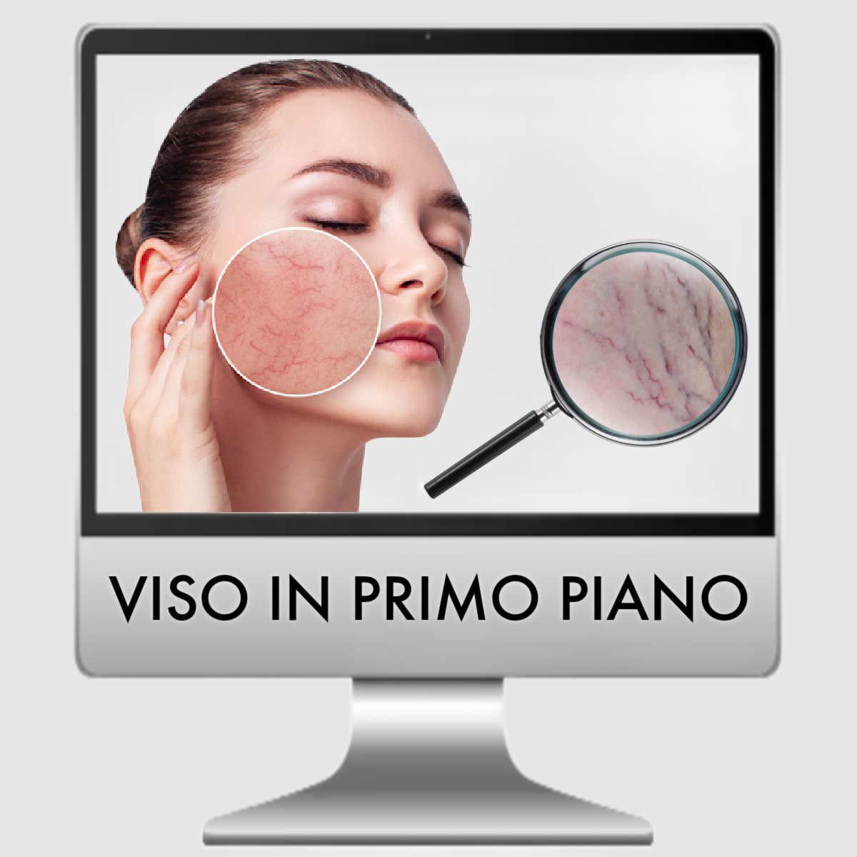 IL LASER CHE ELIMINA I CAPILLARI DAL VISO