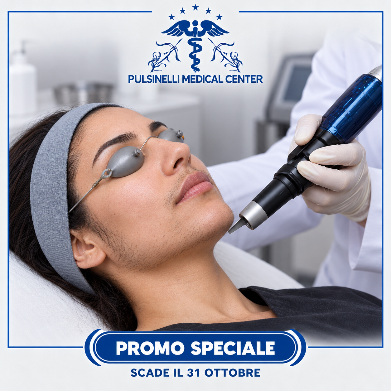 DUE EPILAZIONI LASER ALESSANDRITE : VISO