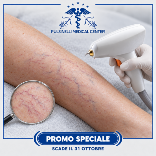 TRATTAMENTO LASER RIMOZIONE CAPILLARI GAMBE