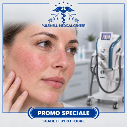 LASER TERAPIA : COUPEROSE ROSACEA E CAPILLARI VISO