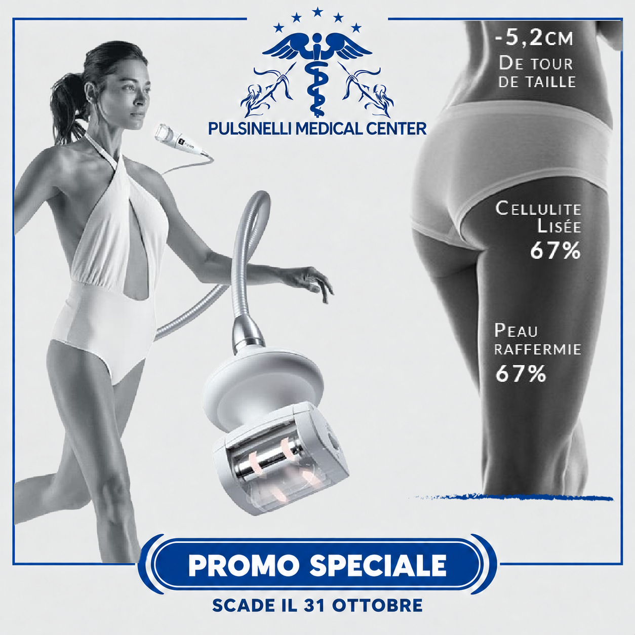 5 LPG ENDERMOLOGIE SNELLIMENTO TOTAL- BODY